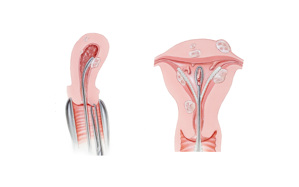 Hysteroscopy hospital near Jayanagar